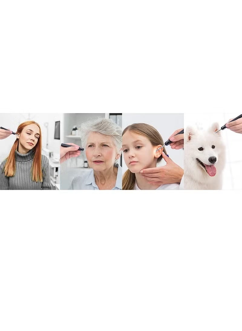 Smart Earwax Removal Kit – See Clearly, Clean Safely 👂📱